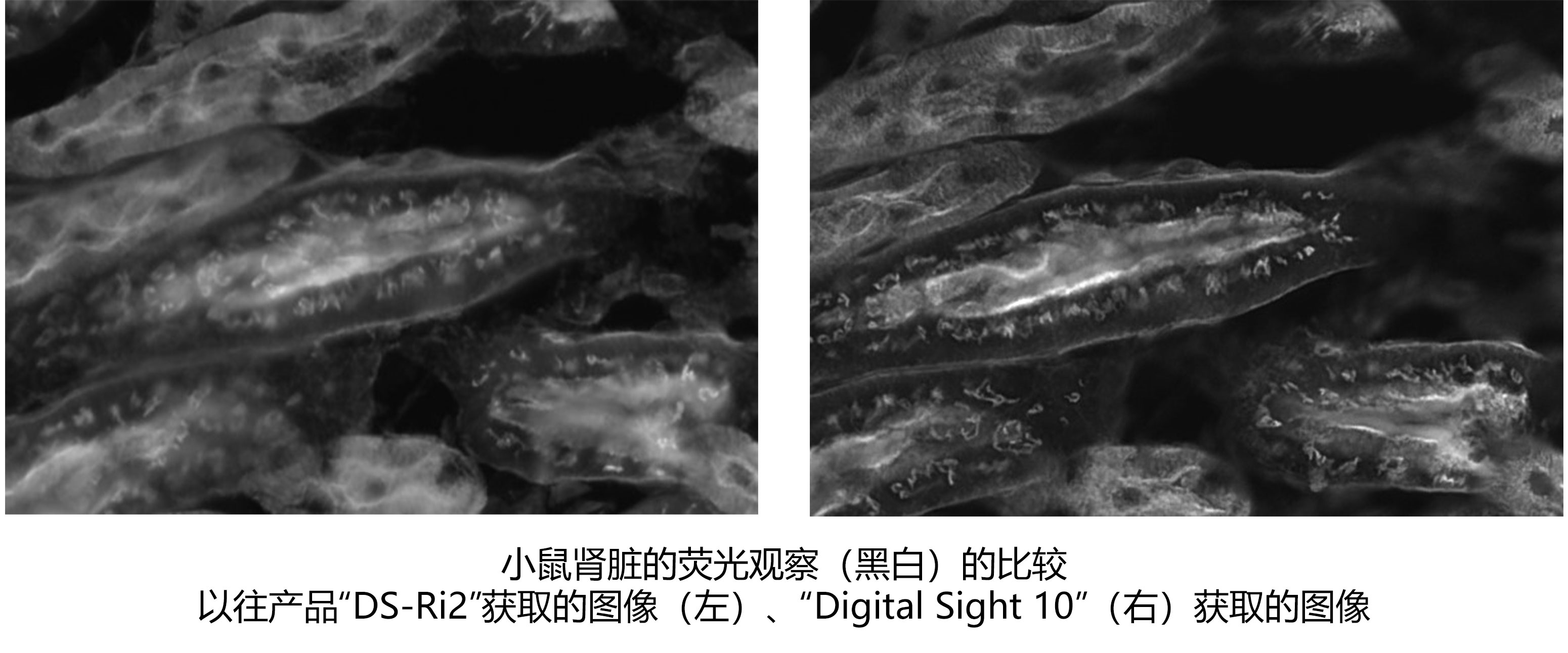 小鼠肾脏的荧光观察（黑白）的比较以往产品“DS-Ri2”获取的图像（左）、“Digital Sight 10”（右）获取的图像