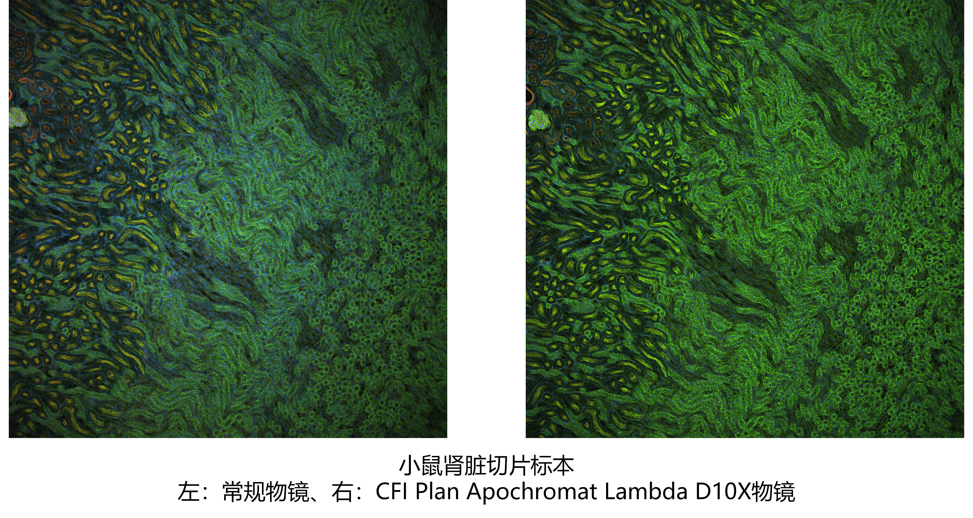 小鼠肾脏切片标本 左：常规物镜、右：CFI Plan Apochromat Lambda D10X物镜