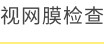 视网膜检查