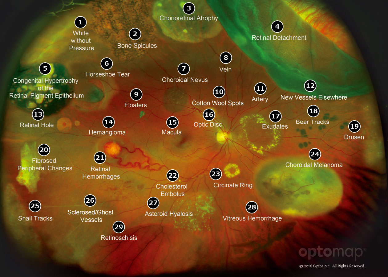 Retinal image