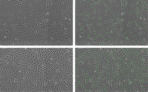 Measurement of MSC number by non-invasive phase contrast image analysis