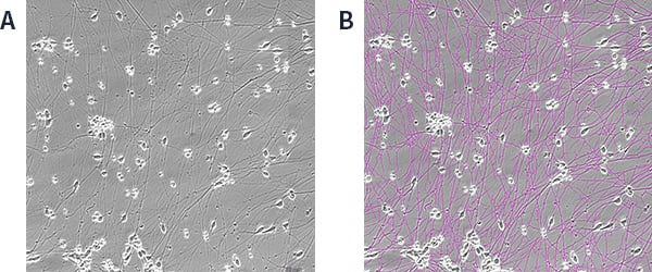 hiPSC-derived GABAergic neuron phase contrast image and mask image with overlay