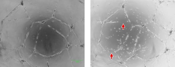 The image on the left is taken under conditions where the state of the cell is easily understood. In the image on the right, blood vessel connections are unclear due to inappropriate exposure (indicated by the arrows), making the image difficult to evaluate. Also, it was difficult to capture an image at the same position every day.
