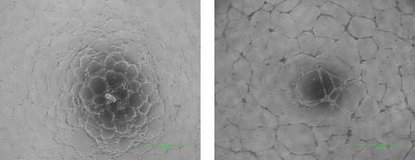 Images of a vascular network forming assay.