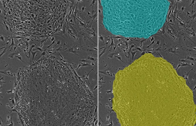 Evaluate culture conditions by accurately measuring the number of cells and growth rate in hPSC colonies without detachment