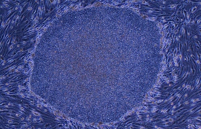 Improving work efficiency and accuracy through automatic measurement of iPS cell reprogramming efficiency
