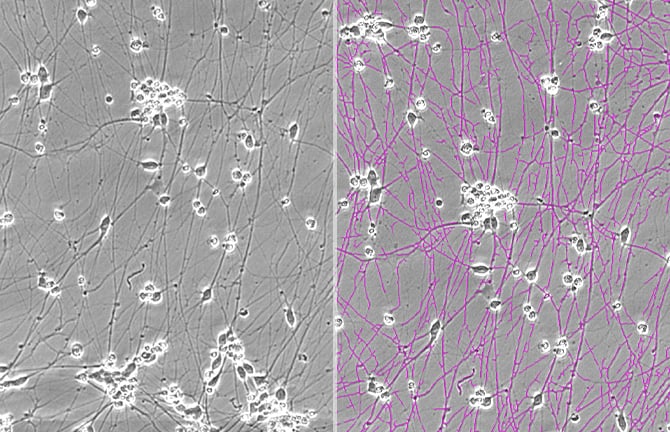 Non-invasive and temporal analysis of neurite length for evaluating differentiation and drug effects