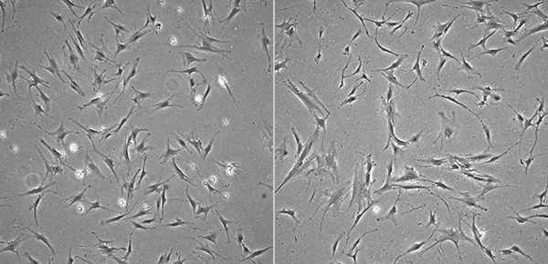 Images of Young (Left) and Senescent (Right) MSCs