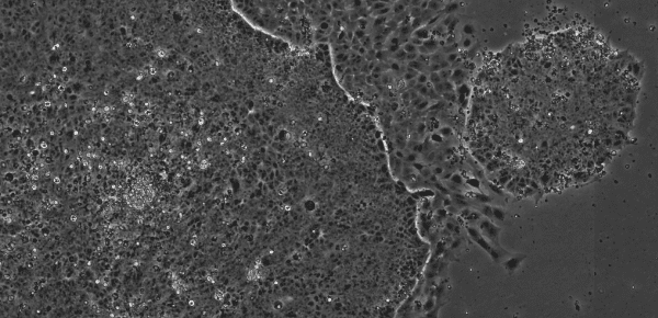 Image of iPS Cells