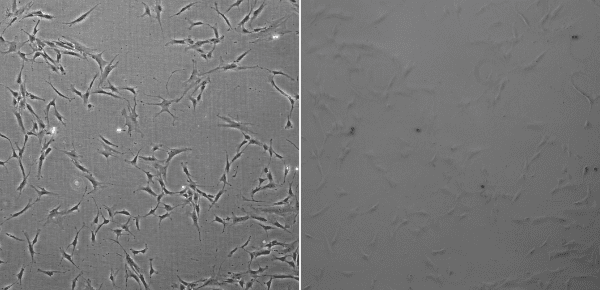 Phase contrast image with a properly aligned phase ring (left), phase contrast image without a phase ring (right)