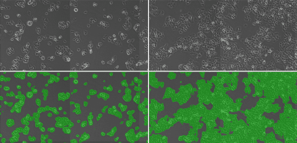 Evaluating cell proliferation over time using phase contrast imaging (top) and subsequent generation of a mask image (bottom) for calculating coverage area.