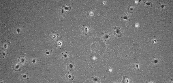 Young and Senescent MSCs