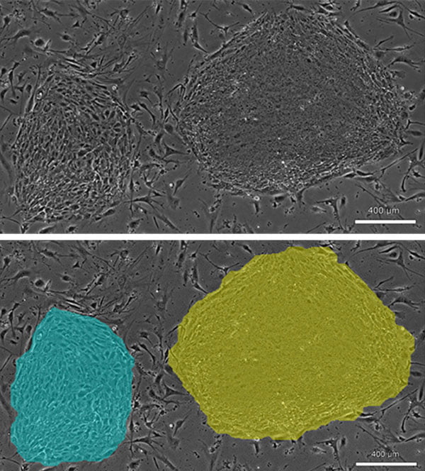 iPS細胞コロニーの位相差画像（上）、画像解析によるコロニー粗密判定（下）