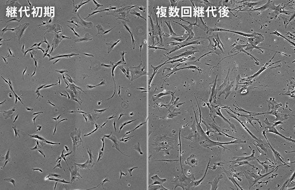 機械学習を用いて構築した学習モデルに基づき位相差画像を判定