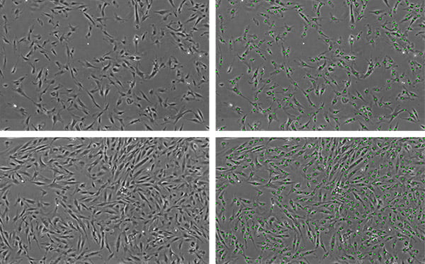 位相差画像を用いた非侵襲的画像解析によるMSC細胞の細胞数計測