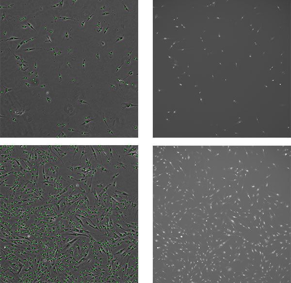 左：位相差画像の画像解析による自動計測結果、右：マニュアルカウントに用いた蛍光画像