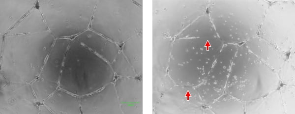 左が細胞の状態がわかりやすい条件で撮影した画像。右の画像は露出条件などが悪いため、血管のつながりがわかりにくく（矢印）、評価しにくい。また、毎日同じ位置で撮影することも難しかった。