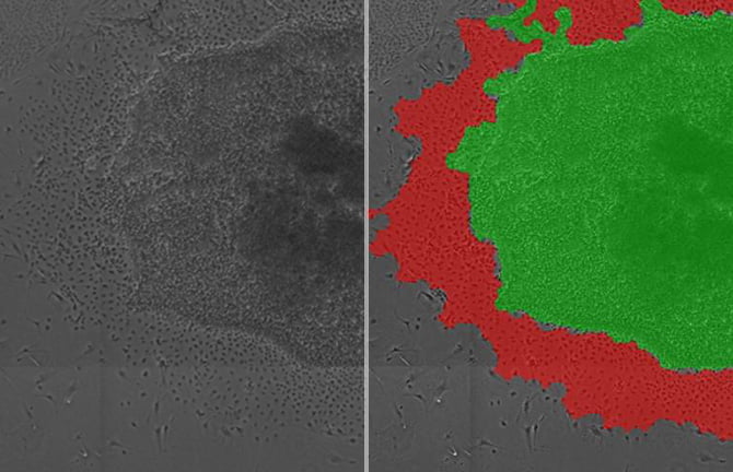 図2：ヒト多能性幹細胞コロニーの解析例（青：粗コロニー、赤：密コロニー）