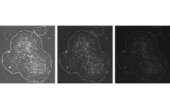 hPSCの画像解析に適した画像を取得するためのポイントは？