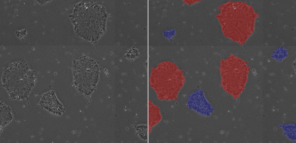 粗な状態のコロニー（青）、密に細胞がパックされた状態のコロニー（赤）