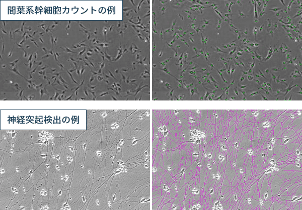 図1：間葉系幹細胞カウントと神経突起抽出の例