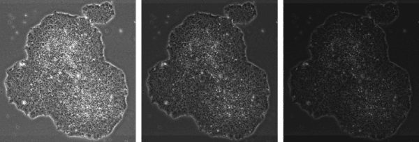 図3：異なる明るさで撮影した時のヒト多能性幹細胞コロニーの見え方