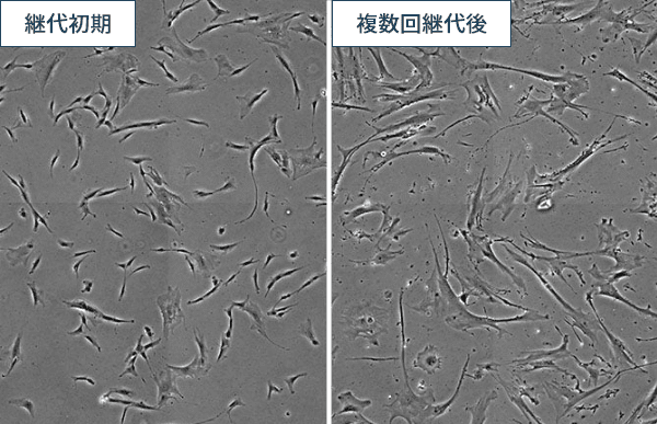 図4:異なる継代回数の間葉系幹細胞の様子