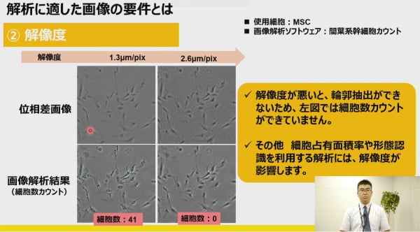 細胞培養時の観察ポイントや解析に適した細胞画像の要件について分かりやすくご紹介