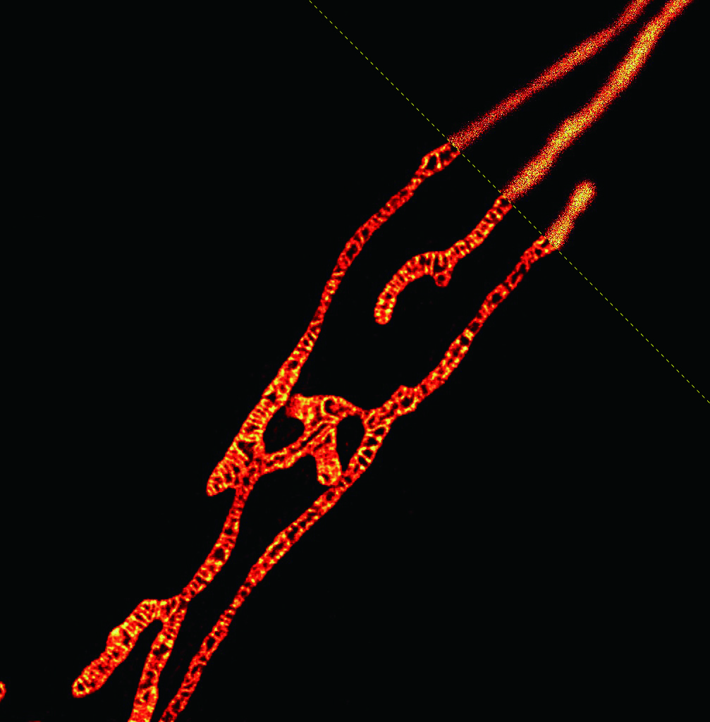 細胞飢餓状態で発達したミトコンドリア内膜の超解像画像